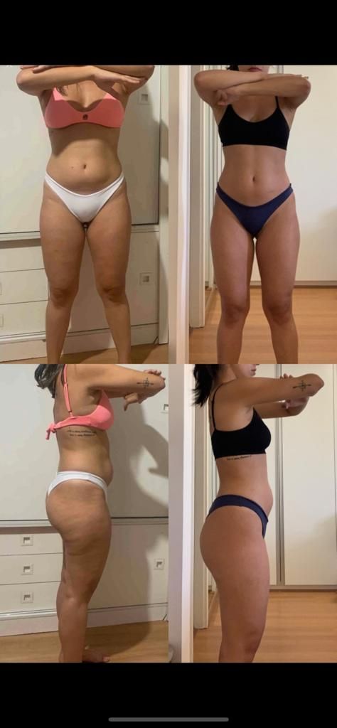 ANTES E DEPOIS — Foto autorizada